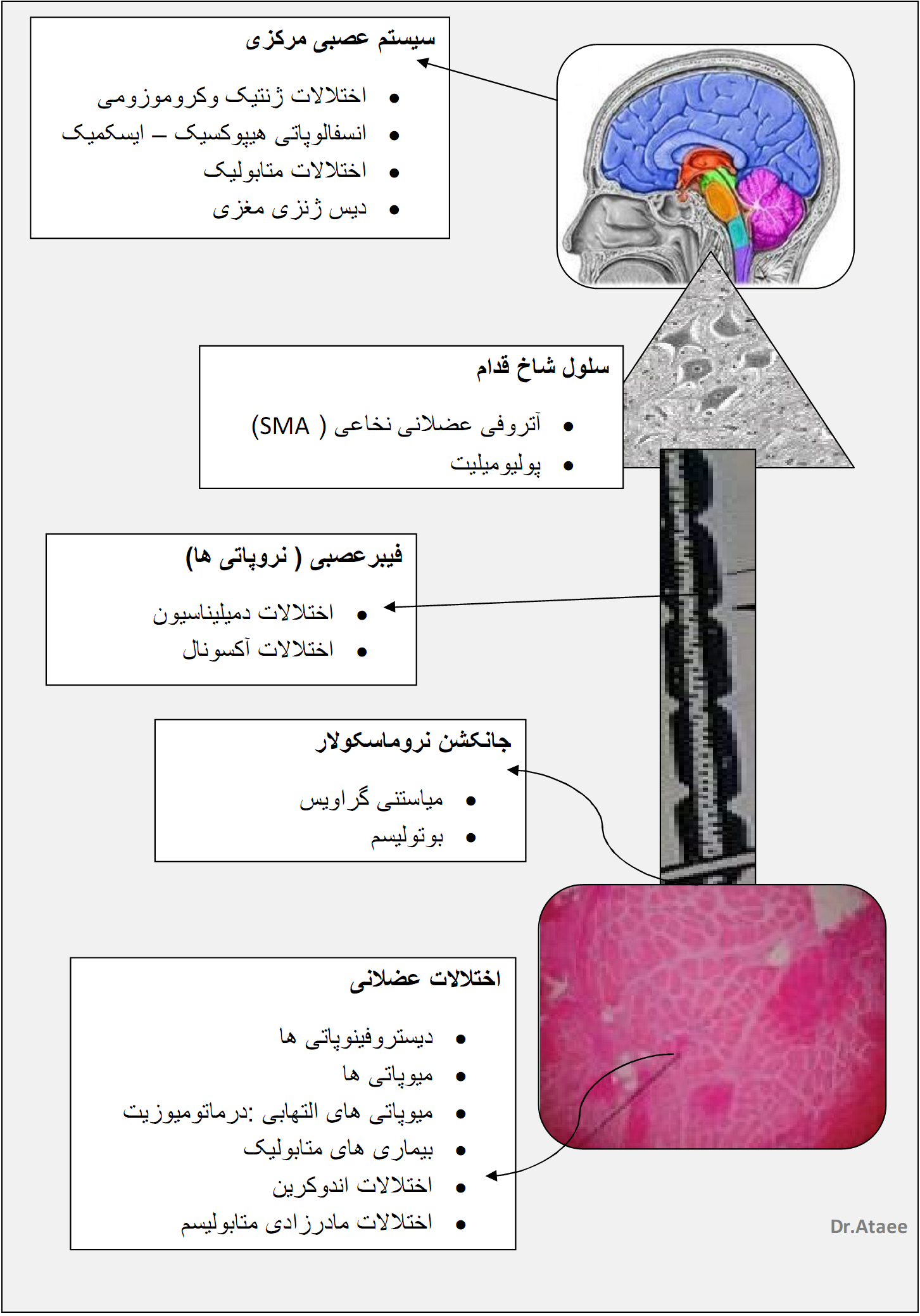 هیپوتونی نوزادان